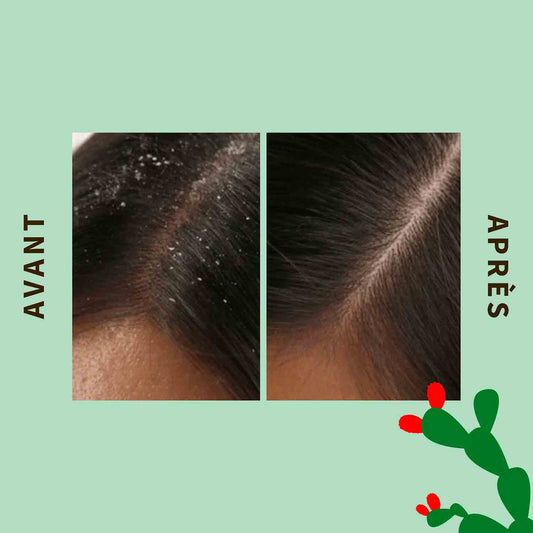 Pure Scrub detoxifying for the scalp